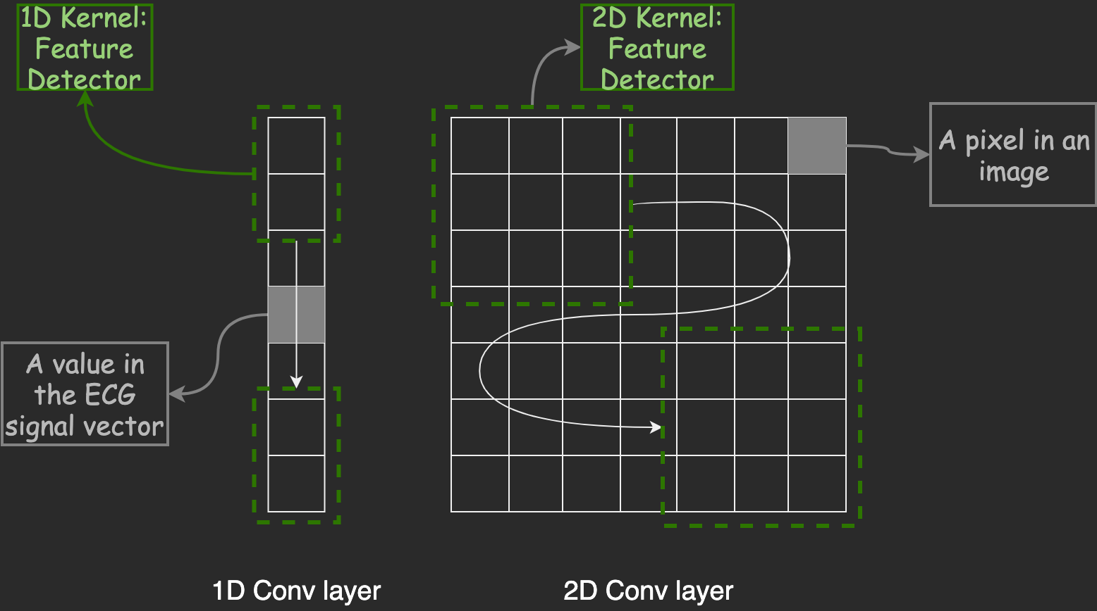 1D Convolution on ECG