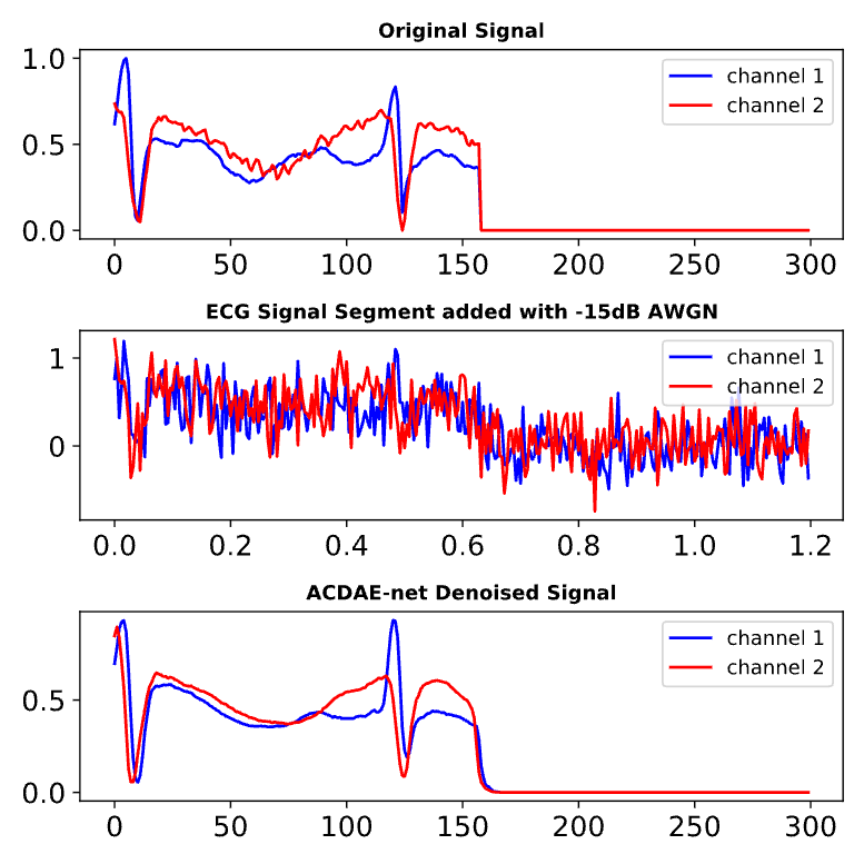 ECG Denoising